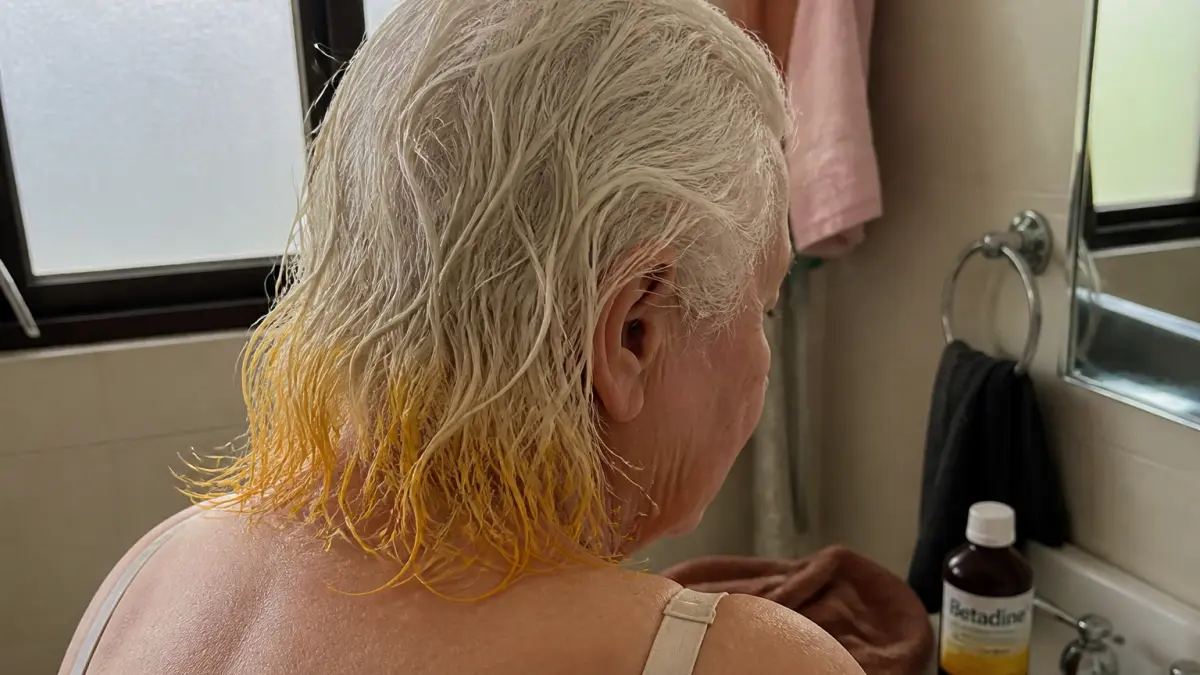 Bétadine sur cheveux blancs : attention aux risques de coloration